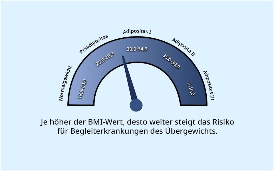 Der BMI-Bereich für Adipositas Grad 1