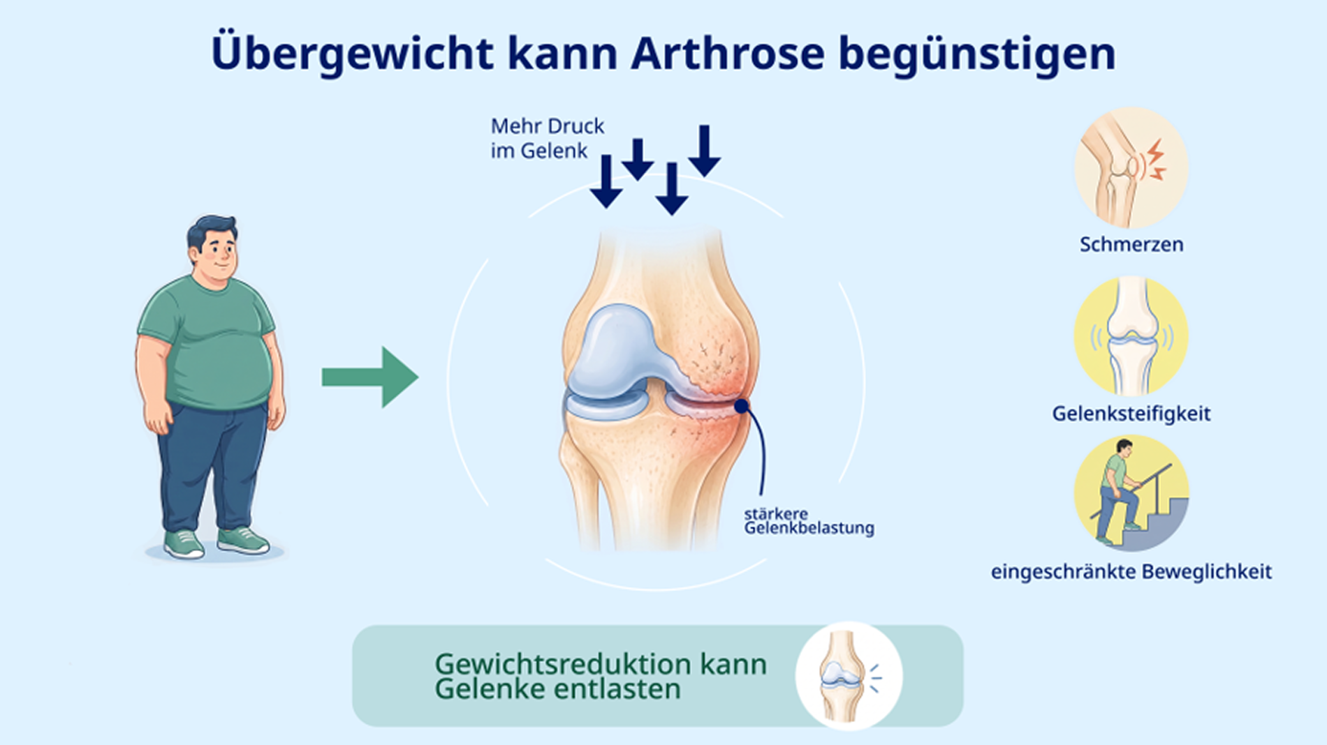 Gezeichnete Darstellung der Auswirkungen von Arthrose bei Übergewicht. 