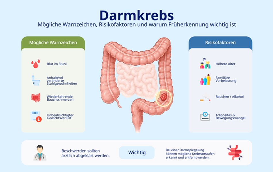 Infografik zu Warnzeichen und Risikofaktoren von Darmkrebs mit einer Darstellung des Darms.