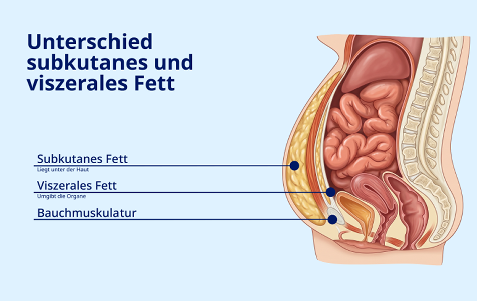 Anatomische Grafik, die subkutanes Fett unter der Haut, viszerales Fett um die Organe und die Bauchmuskulatur zeigt.