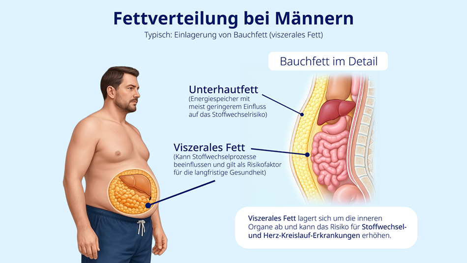 Übergewicht bei Männern mit besonderem Augenmerk auf die Fettverteilung.