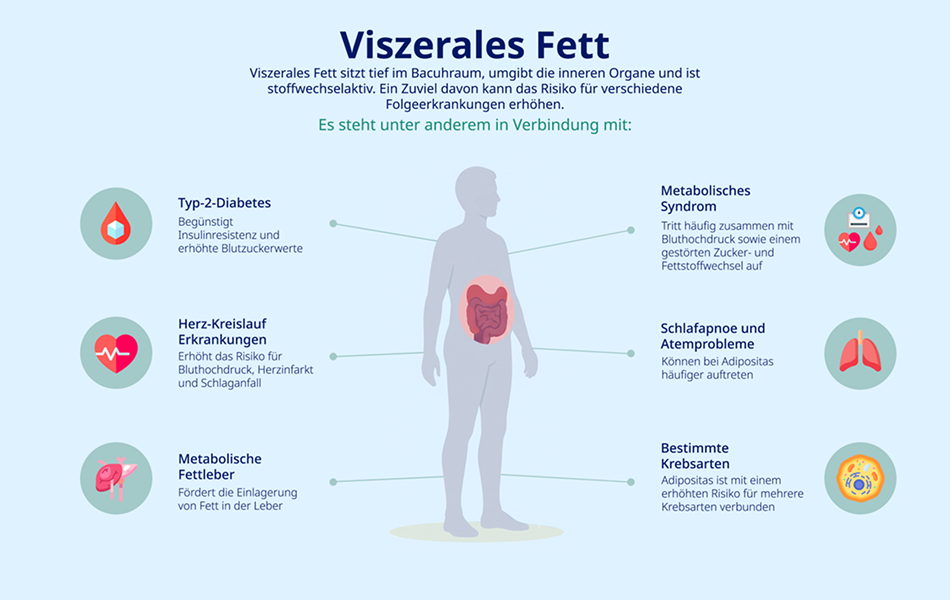 Übersichtsgrafik zu möglichen Folgen von viszeralem Fett wie Typ-2-Diabetes, Herz-Kreislauf-Erkrankungen und Fettleber.